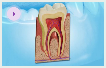 Bleeding Inflamed Gums