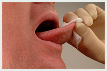 Mouth Cancer Screening